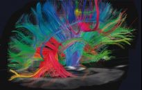 Miłość jest jak narkotyk