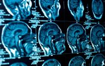 Oddział neurologiczny w Wojewódzkim Szpitalu Specjalistycznym