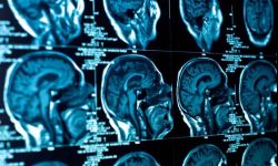 Oddział neurologiczny w Wojewódzkim Szpitalu Specjalistycznym