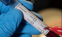 8 nowych zachorowań na koronawirusa. Najwięcej w tarnobrzeskim