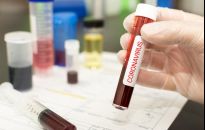 Na Podkarpaciu 61 osób zarażonych i prawie 11 tys. objętych kwarantanną