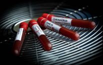 W Jarosławiu zmarł  85-letni mężczyzna. 15 osób wyzdrowiało. Koronawirus