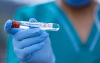 565 przypadków COVID-19 na Podkarpaciu i 48 osób zmarło