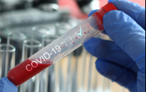 Aż 115 zachorowań na COVID-19 na Podkarpaciu. Najwięcej w Rzeszowie