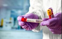 Ponad 3 tys. zachorowań w Polsce. Zmarła 40-letnia kobieta z rzeszowskiego