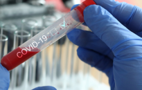 Rekord na Podkarpaciu! 563 nowych zachorowań i aż 17 ofiar śmiertelnych