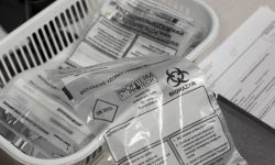 Kraska: Katowicki sanepid potwierdził pierwszy przypadek wariantu omikron w Polsce