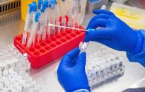 Kraska: ponad 50 tys. nowych zakażeń koronawirusem