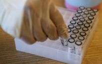 188 zakażeń koronawirusem; nikt nie zmarł z powodu COVID-19