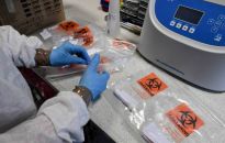 346 zakażeń koronawirusem, z powodu COVID-19 zmarło 7 osób