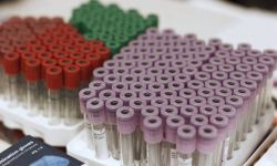 Ministerstwo Zdrowia: od 16 do 22 czerwca wykryto 1341 zakażeń, zmarło 17 osób z COVID-19